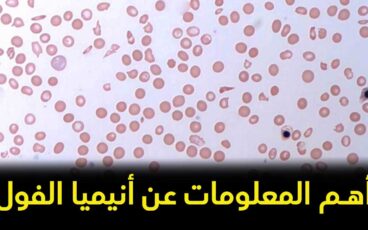 أهم المعلومات عن فقر الدم الفولي